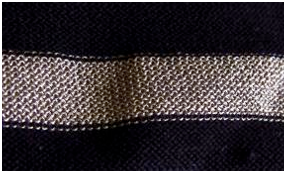 Figure 1 Textile electrodes consisting of electroconductive fibers integrated in knitted fabrics.