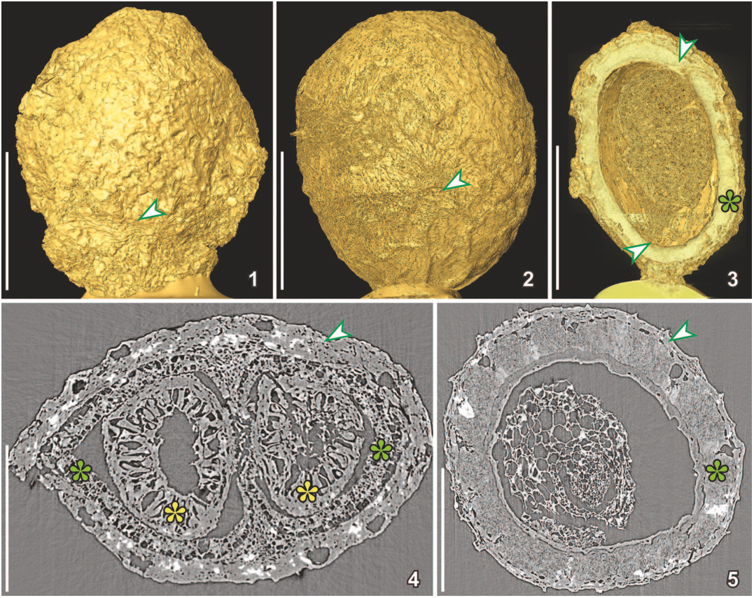 FIGURE 6—Three-dimensional (1–3) and 2-D (4, 5) SRXTM reconstructions of two charcoalified fruits with similar external morphology, but different internal structure; 1, surface rendering of Canrightia resinifera (S171508) from the Early Cretaceous Catefica locality, Portugal, showing slightly wrinkled surface of fleshy fruit wall and short hypanthium (arrowhead); dataset acquired using 103 objective and a 20 lm thick LAG:Ce scintillator at 10 keV (voxel size 0.74 lm); 2, surface rendering of Canrightia-like fruit (S174033) from the Early Cretaceous Famalicão locality, Portugal, showing slightly wrinkled surface of fleshy fruit wall and scars from stamens (arrowhead) on the fruit surface; dataset acquired using 203 objective and a 20 lm thick LAG:Ce scintillator at 10 keV (voxel size 0.325 lm); 3, combined surface rendering and cut voltex (transparent rendering) of Canrightia-like fruit (S174105) from the Early Cretaceous Buarcos locality, Portugal, in longitudinal section showing a single, hemi-orthotropous and pendulous seed with chalaza and vascular bundles entering the seed close to apex (arrowhead) and micropyle directed towards the base (arrowhead) and with thick crystalliferous endotesta (green asterisk); dataset acquired using 203 objective and a 20 lm thick LAG:Ce scintillator at 10 keV (voxel size 0.325 lm); 4, transverse orthoslice of Canrightia resinifera (same dataset as for 1) showing fruit wall (arrowhead) enclosing two ovules/seeds with the seed wall composed of crystalliferous and fibrous endotesta (green asterisks) and a thick endotegmen composed mainly of endothelium cells (yellow asterisks); 5, transverse orthoslice of Canrightia-like fruit with collapsed fruit wall (arrowhead) enclosing a single seed (same dataset as for 2); seed wall mainly composed of crystalliferous and fibrous endotesta and with grooves giving the seed surface a pitted appearance; inside are remains of endosperm and embryo. Scale bars for 1–3¼500 lm; for 4, 5¼250 lm.